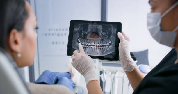 Licensed Teeth Whitening service in Hilton Head Island, SC - Smile Center Dentistry